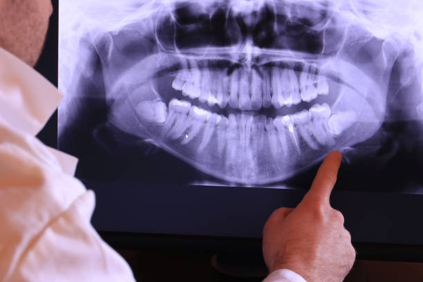 Best Emergency Treatment for Oral Infections in Bound Brook, NJ